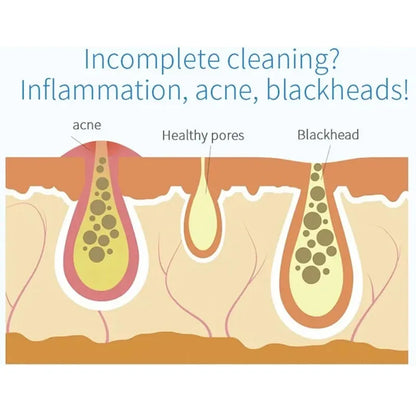 2IN1 Small Bubble Vacuum Acne Pore Cleaner