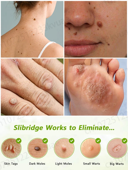 Say goodbye to the embarrassment