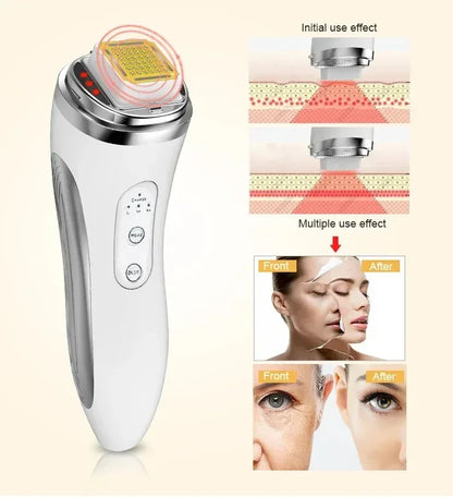 Electric Facial Lifting Machine